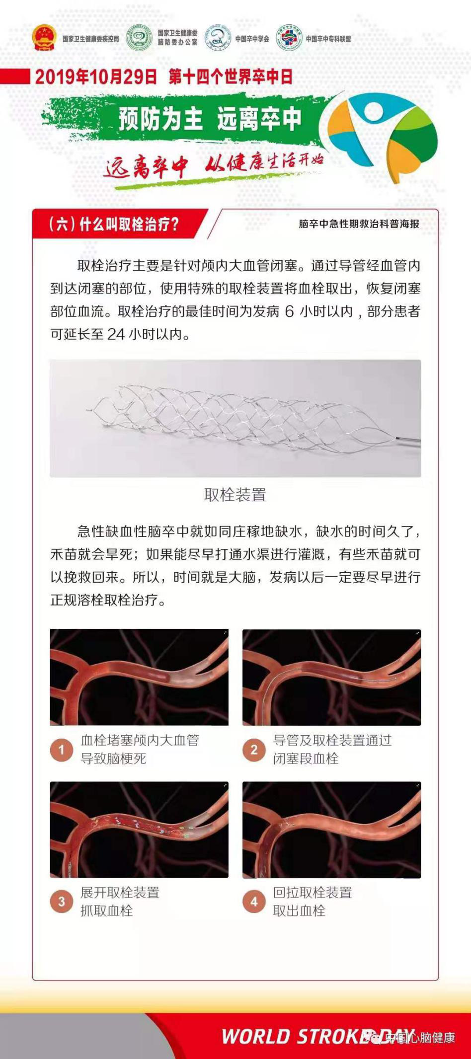 世界卒中日|远离卒中 从健康生活开始