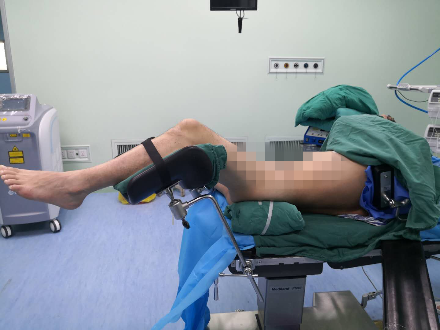 赞！不用开刀就能把肾脏内8公分大的囊肿取出来