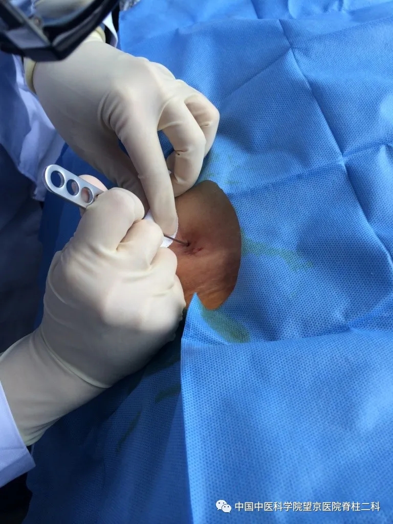 【医讯】中国中医科学院望京医院杨克新专家团队9月18日—19日到漳州市中医院坐诊