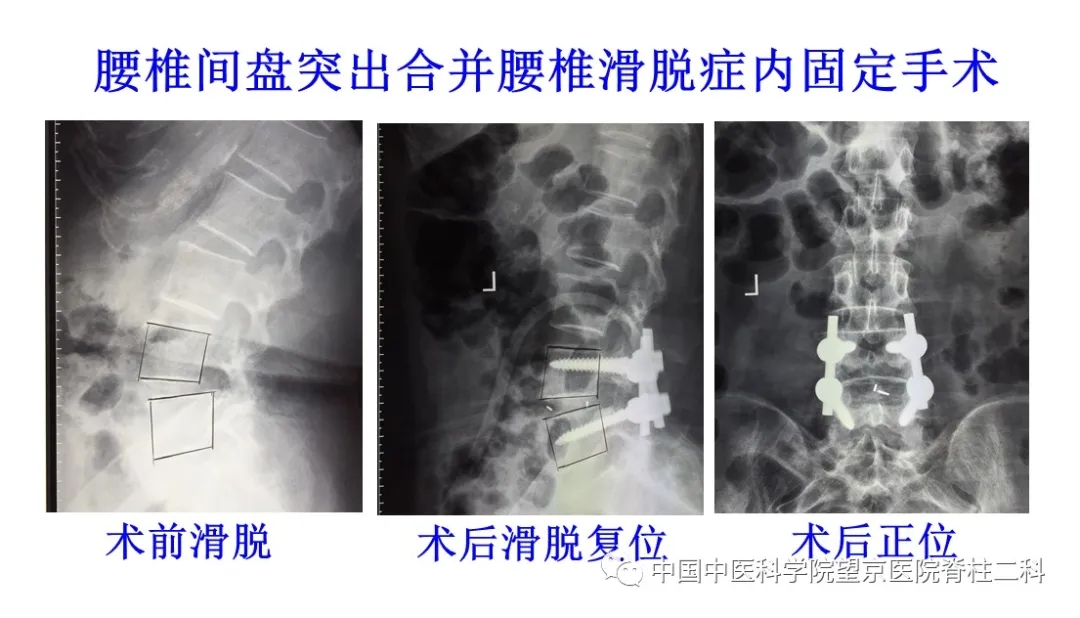 【医讯】中国中医科学院望京医院杨克新专家团队9月18日—19日到漳州市中医院坐诊