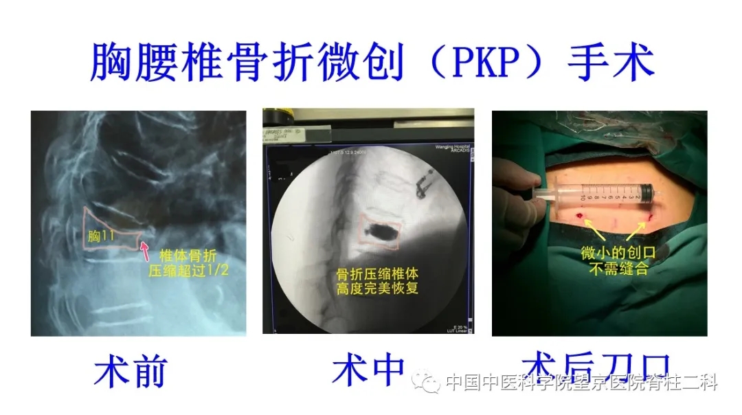 【医讯】中国中医科学院望京医院杨克新专家团队9月18日—19日到漳州市中医院坐诊