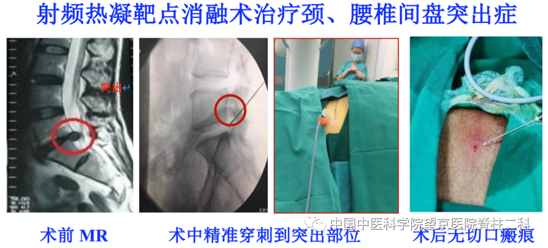 【医讯】中国中医科学院望京医院杨克新专家团队9月18日—19日到漳州市中医院坐诊