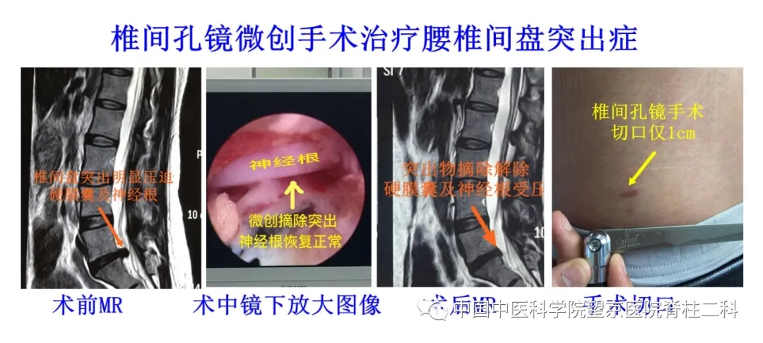 【医讯】中国中医科学院望京医院杨克新专家团队9月18日—19日到漳州市中医院坐诊