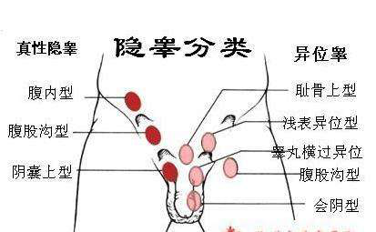 消失的“蛋蛋”去哪儿了