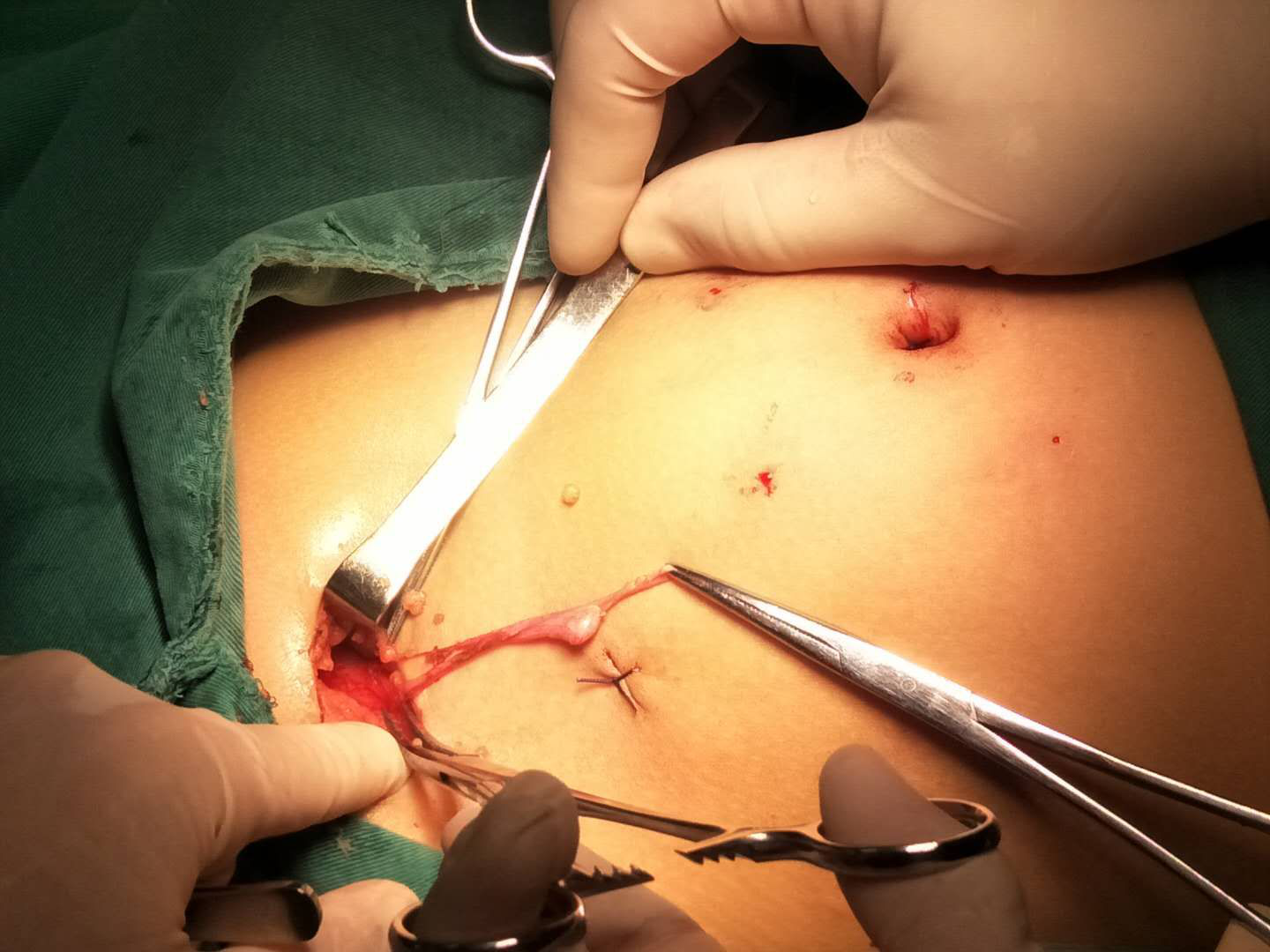 消失的“蛋蛋”去哪儿了