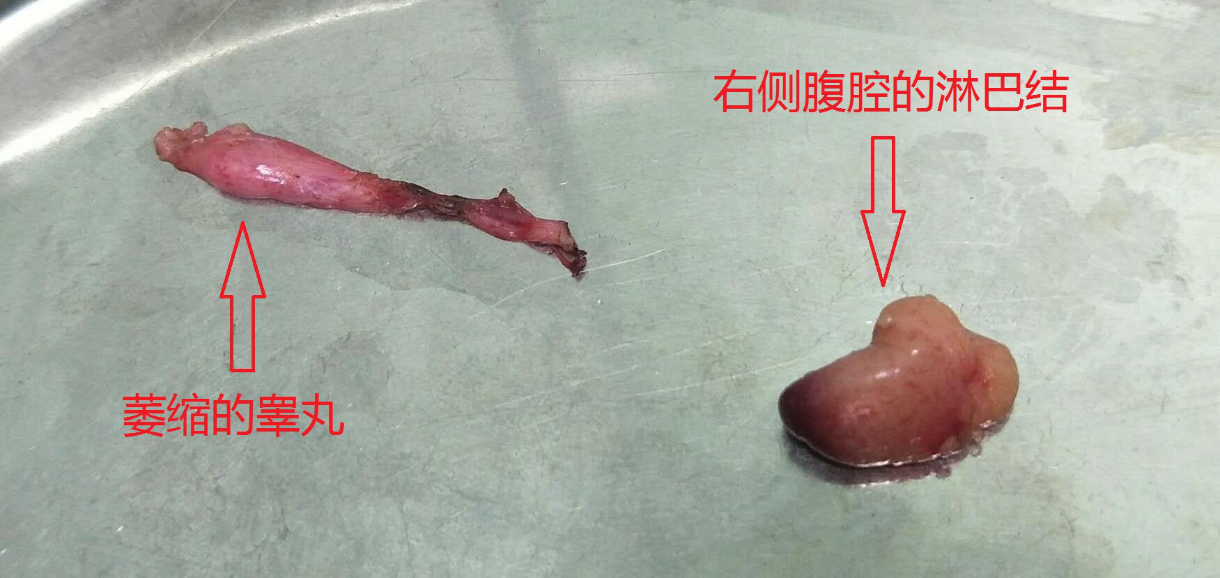 消失的“蛋蛋”去哪儿了