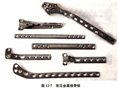 骨折了，医生为什么不马上给我动手术？