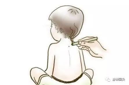 三伏灸一灸  疾病绕道走｜2021年“三伏灸”火热进行中！