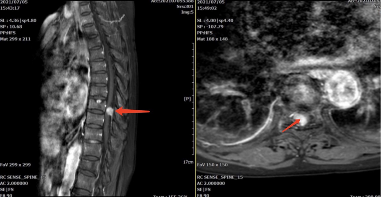 骨科手术机器人助推我院骨伤科跃进精准治疗新高地