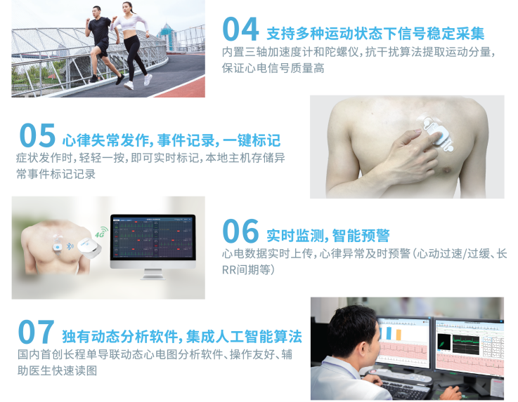长程动态心电图——让心脏的潜伏杀手无所遁形