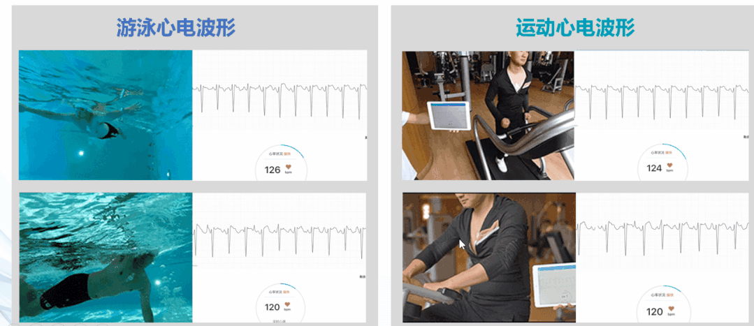 长程动态心电图——让心脏的潜伏杀手无所遁形