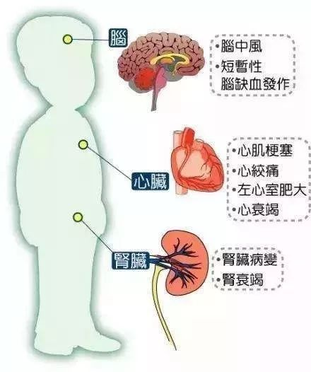 高血压小知识