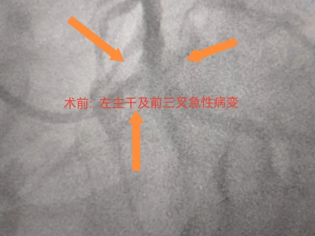 术前.jpg