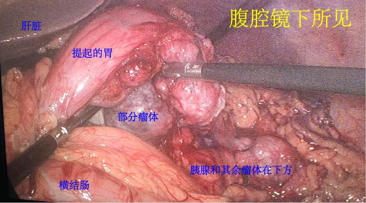 微信图片_20251017172523_1868_208.jpg 微信图片_20251017172523_1868_208.jpg