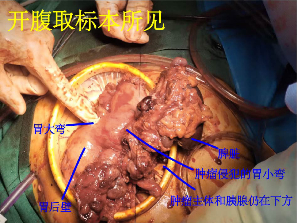 微信图片_20251017180706_1002_383.jpg 微信图片_20251017180706_1002_383.jpg