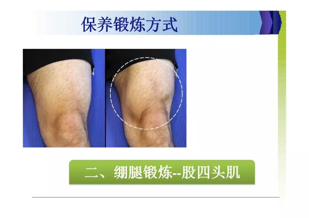 世界关节炎日 |爱护关节 健康生活